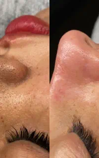 فیشیال تخصصی فقط۹۰۰