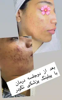 فیشال تخصصی ۱۴ مرحله ای (۵۵۰ تومان) دوشنبه