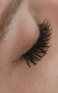 کاشت موقت مژه
