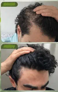 به موهات یه شانس دوباره بده