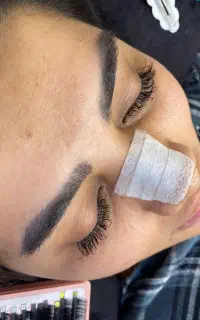 کاشت مژه
