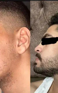 یه بار درمانش کن یه عمر لذت ببر