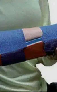 شکسته بندی سیار ب تمام نقاط شهر