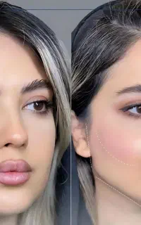۵۰درصدتخفیف ژل،بوتاکس،هایفو،بلفارو،انواع لیفت صورت