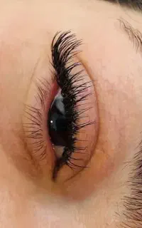 کاشت مژه