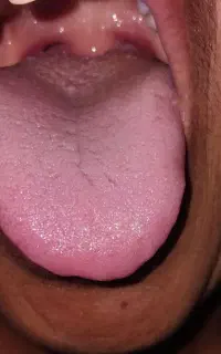 تشخیص تمام بیماری ها ازروی عکس زبان