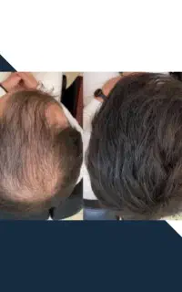 تار های موهات افزایش  بده