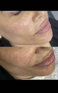 وقت درخشش پوستت رسیده .
