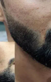 احیا کننده‌ی ریش،مو،ابرو و مژه