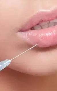 تخفیف ویژه بوتاکس (اف ویژه فقط ۹۹۰)