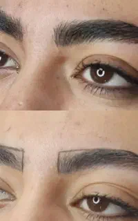میکروبلیدینگ ابرو فیبروز ابرو