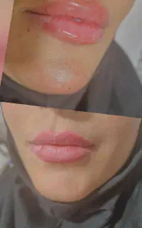 انواع خدمات زیبایی زیر نظر پزشک