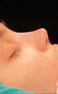 جشنواره عمل های زیبایی