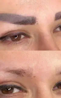 ریمووابرو/خط چشم /تتوی بدن ۷۰۰