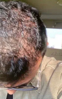 ماژول تکامل سازی مو