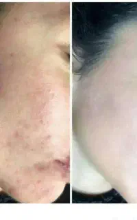 کرم معجزه اصل بدون ذره ای ناخالصی بدون کورتون