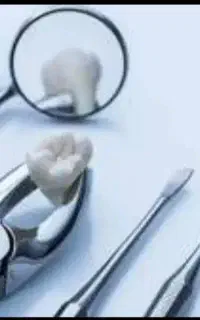 دندانسازی،دندان مصنوعی(اوردنچر)/ پروتز ثابت