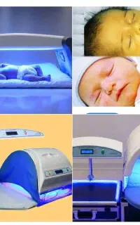 اجاره دستگاه زردی نوزاد (فتوتراپی)کل تهران تضمینی