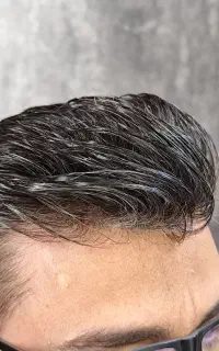 پروتزمو /خط رویش تار به تار /