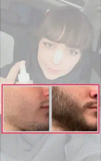 ر.ویش ریش ۲۵ روزه