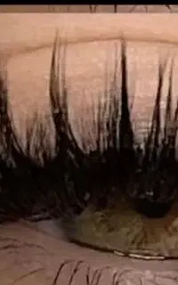 اکستیشن مژه