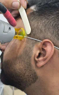 لیزر موی زائد از۱۵تا۱۹اردیبهشت باکندلا اصل آمریکا