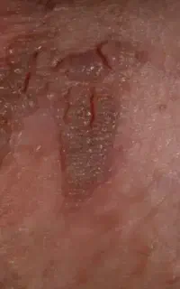 مشاوره علمی و عملی برای بازگشت به زندگی نرمال