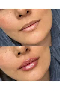 خدمات ژل و تتو صورت