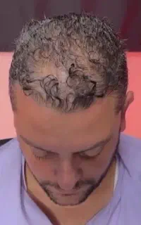 پرپشتی موهات برمیگرده