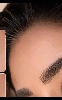جذب محدود مدل کاشت ابروبا هزینه ویژه زیرنظر متخصص