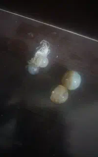 سنگ مهره