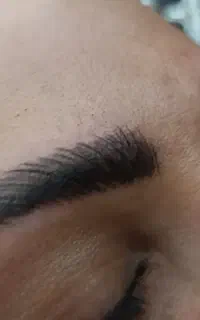 میکروبلیدینگ