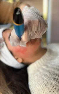 آموزش فیشیال،پاکسازی پوست در آموزشگاه رسمی