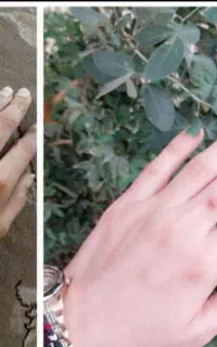 کرم معجزه سفید برفی شو
