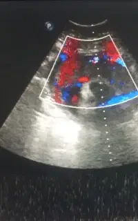 آموزش و طراحی نیاز