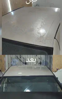 رفع آفتاب سوختگی ،پولیش واکس لیسه با قیمت منصفانه
