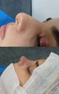جشنواره محدود بینی دراهواز۲۵ت تااخرهفته