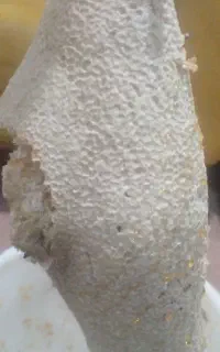 عسل درمانی