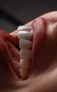 دندانپزشکی/کامپوزیت/اقساط/لمینیت/ایمپلنت