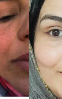 قوی ترین ضدلک دنیاس کرم بیومنتیک