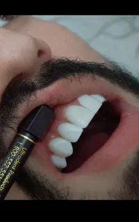 آموزش دندانپزشکی