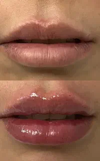 تخفیفات کلیه خدمات زیبایی در مطب پزشک
