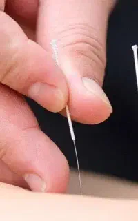دستیار و آموزش طب سوزنی