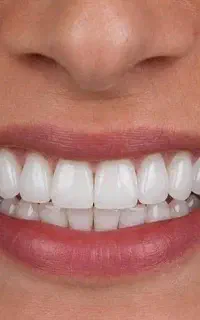 استخدام کارشناس فروش خانم در دندانپزشکی