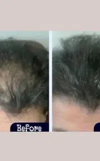 موهات میشه مثل یه جنگل