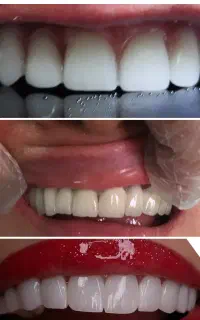 خدمات دندانپزشکی و دندانسازی مستر دنت (اقساط)