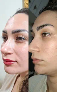 شیدینگ لب آرایش تخصصی دائم لب