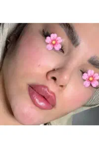 تزریق فول فیس