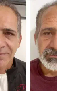 اف ویژه تعریق عرق و بوی بد