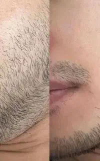 ریش داشته باش تا ریشه دار باشی